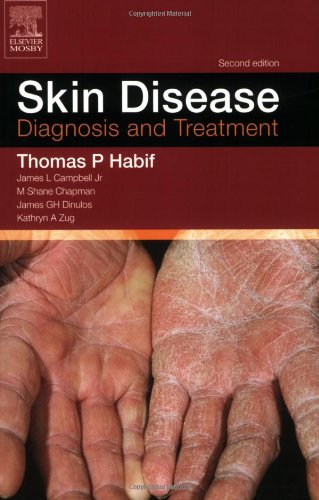 Skin Disease: Diagnosis and Treament