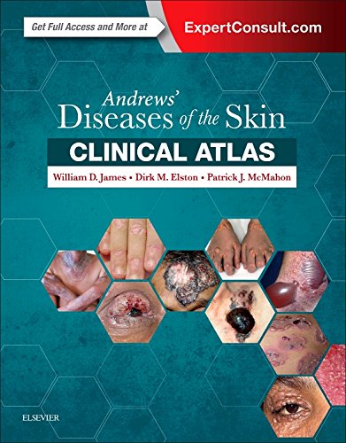 Andrews' Diseases of the Skin Clinical Atlas, 1e