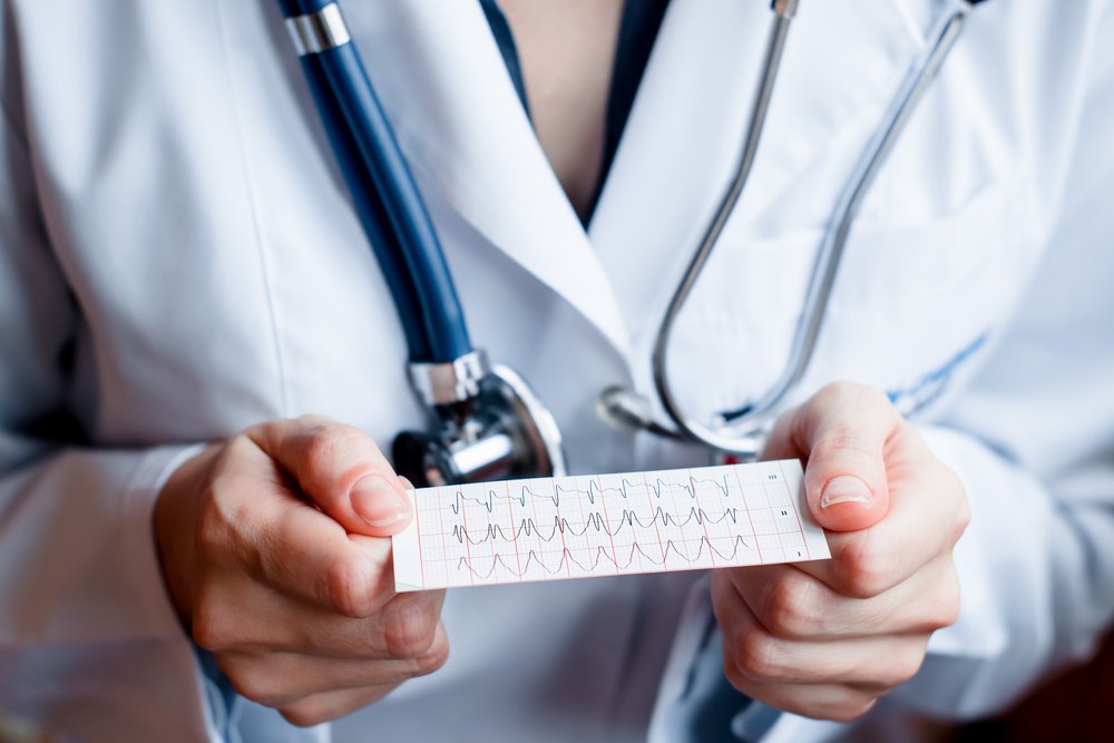 Electrocardiogram, ECG in hand, palm of a doctor. Medical health care. Clinic cardiology heart rhythm and pulse test closeup. Cardiogram printout.