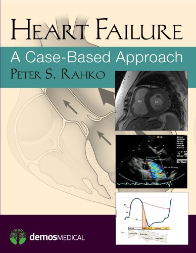 Heart Failure: A Case-Based Approach