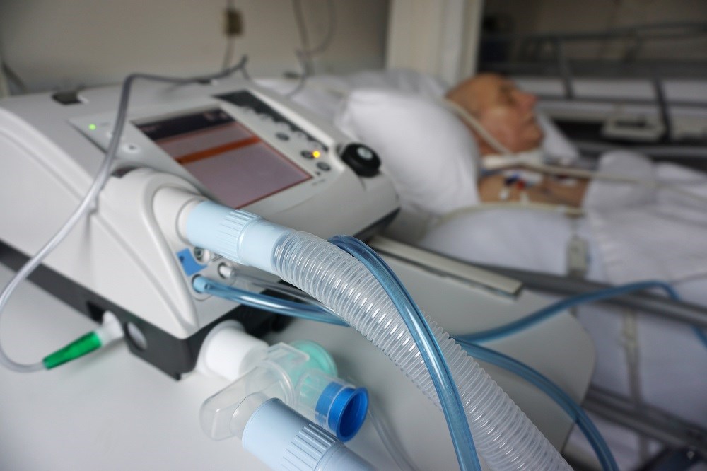 The trial would need to enroll approximately 107,373 patients to have a 96% power to detect a 3% improvement in mortality at 80% to 100% adherence to low tidal volume ventilation.