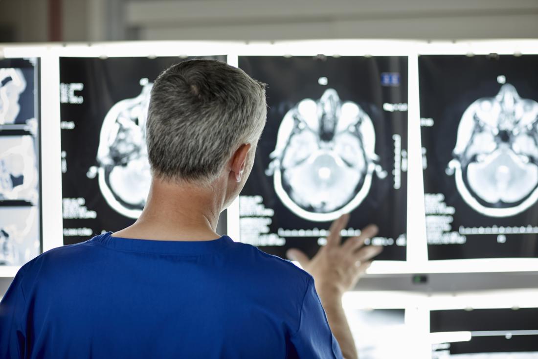 researcher assessing brain scan